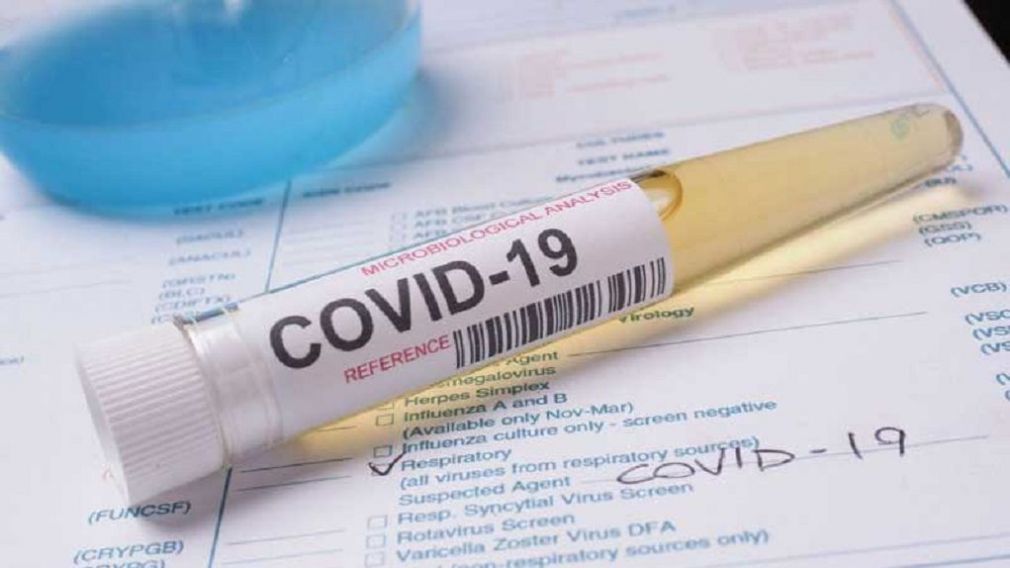 Ενημέρωση για την εξέλιξη της νόσου COVID-19 στη χώρα μας (17/4/2020)